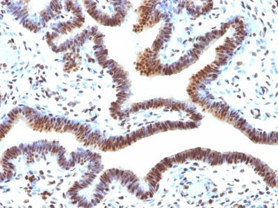SUMO 2 Monoclonal Mouse Antibody (SUMO2/1199)