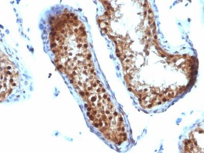 SUMO 2 Monoclonal Mouse Antibody (SUMO2/1199)