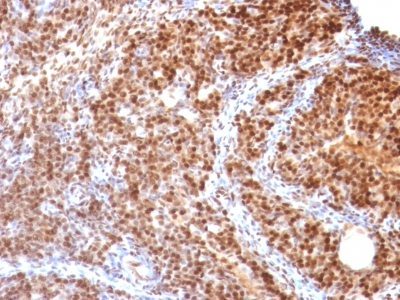 SUMO 2 Monoclonal Mouse Antibody (SUMO2/1199)