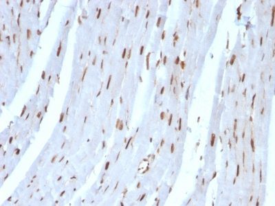 SUMO 2 Monoclonal Mouse Antibody (SUMO2/1199)