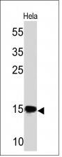 SUMO 2/3 Monoclonal Mouse Antibody (SM23/496)