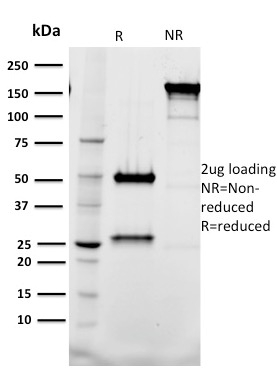 Tal1 Monoclonal Mouse Antibody (BTL73)