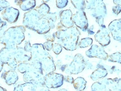 Superoxide Dismutase 1 Monoclonal Mouse Antibody (SOD1/2089)