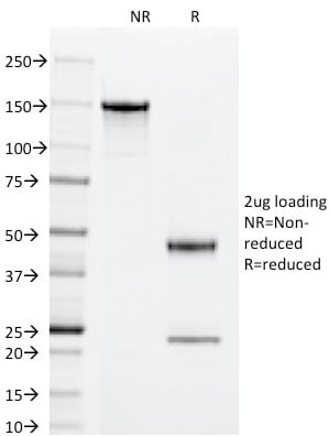 Superoxide Dismutase 1 Monoclonal Mouse Antibody (SOD1/2089)