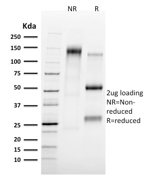 Tal1 Monoclonal Mouse Antibody (TAL1/2707)