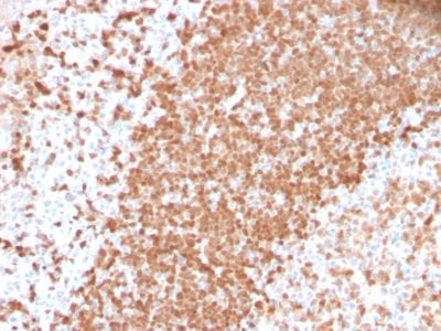 TCL1 Recombinant Monoclonal Rabbit Antibody (TCL1/2747R)