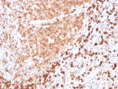 TCL1 Recombinant Monoclonal Rabbit Antibody (TCL1/2747R)