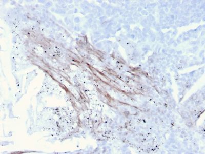 Tenascin C Recombinant Monoclonal Mouse Antibody (TNC/3635)