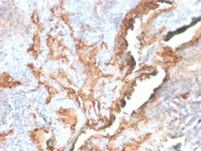 Tenascin C Recombinant Monoclonal Rabbit Antibody (TNC/2981R)
