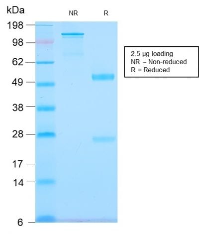 Tenascin C Recombinant Monoclonal Rabbit Antibody (TNC/2981R)