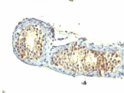 TGF-Alpha Monoclonal Mouse Antibody (1E8-G6)