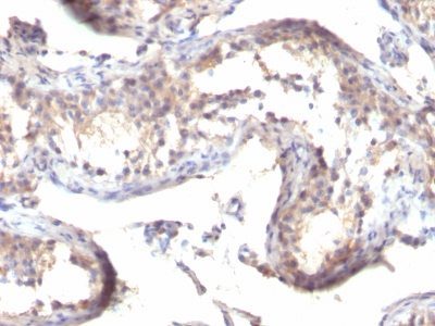TGF-Alpha Monoclonal Mouse Antibody (MF9)