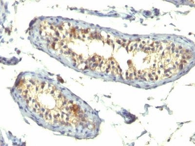 TGF-Alpha Monoclonal Mouse Antibody (TG86 + P/T1)