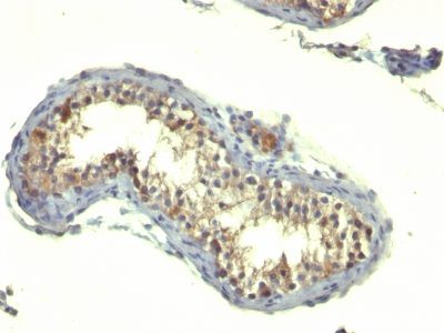 TGF-Alpha Monoclonal Mouse Antibody (TG86)
