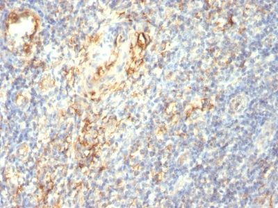TGF-Beta Monoclonal Mouse Antibody (1D11.16.8)