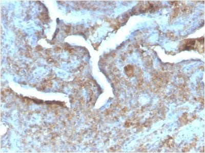Thymidine Phosphorylase / PD-ECGF Recombinant Monoclonal Rabbit Antibody (TYMP/2890R)