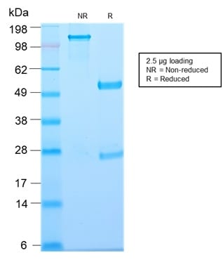 Thymidine Phosphorylase / PD-ECGF Recombinant Monoclonal Rabbit Antibody (TYMP/2890R)