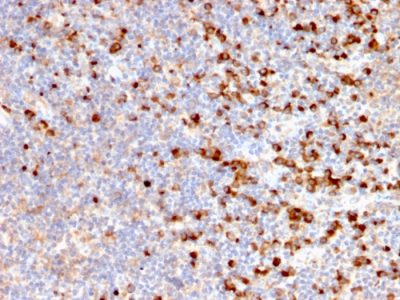 TIM3 / HAVCR2 / CD366 Monoclonal Mouse Antibody (HAVCR2/192)