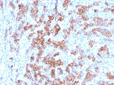 TIM3 / HAVCR2 / CD366 Monoclonal Mouse Antibody (TIM3/3113)