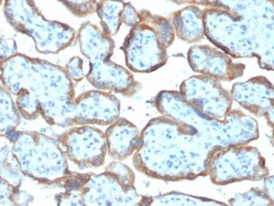TIMP2 Monoclonal Mouse Antibody (TIMP2/2044)