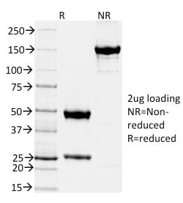TIMP2 Monoclonal Mouse Antibody (TIMP2/2044)