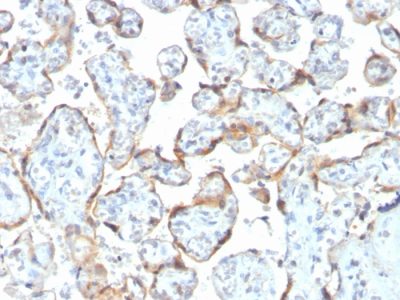 TIMP2 Recombinant Monoclonal Mouse Antibody (rTIMP2/2335)
