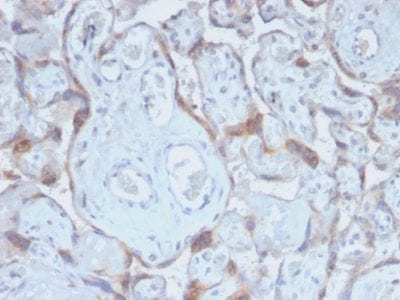 TIMP2 Recombinant Monoclonal Rabbit Antibody (TIMP2/2488R)
