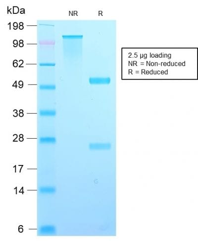 TIMP2 Recombinant Monoclonal Rabbit Antibody (TIMP2/2488R)