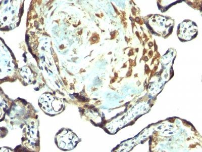 TIMP3 Polyclonal Rabbit Antibody (PAb)