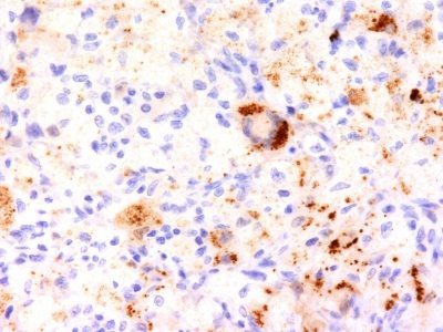 TNF-Alpha Monoclonal Mouse Antibody (J2D10)