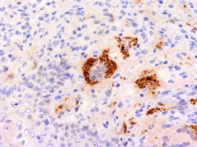 TNF-Alpha Monoclonal Mouse Antibody (P/T2)