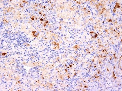 TNF-Alpha Monoclonal Mouse Antibody (TNF706 + P/T2)
