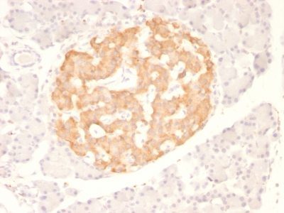 TNF-Alpha Monoclonal Mouse Antibody (TNF706)