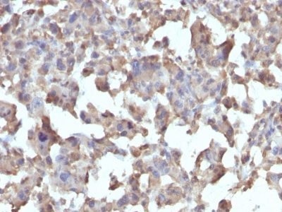 TNF-Alpha Monoclonal Mouse Antibody (TNFA/1172)