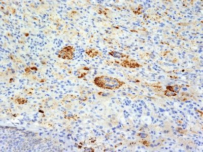 TNF-Alpha Monoclonal Mouse Antibody (TNFA/1172)