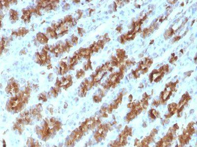 TNF-Alpha Monoclonal Mouse Antibody (TNFA/1172)