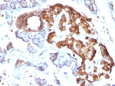 TNF-Alpha Monoclonal Mouse Antibody (TNFA/1172)