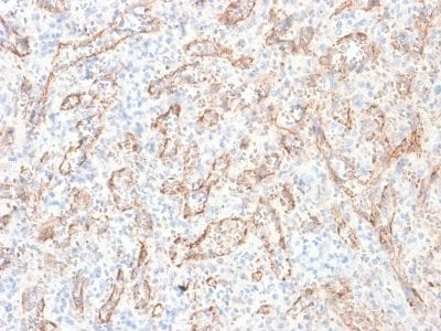 TNFSF15 / VEGI Recombinant Monoclonal Mouse Antibody (rVEGI/1283)