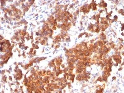 TNFSF15 / VEGI Recombinant Monoclonal Mouse Antibody (rVEGI/1283)
