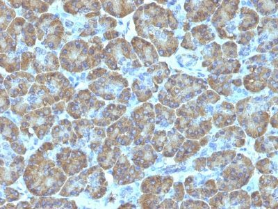 Topoisomerase I, Mitochondrial Monoclonal Mouse Antibody (TOP1MT/488)