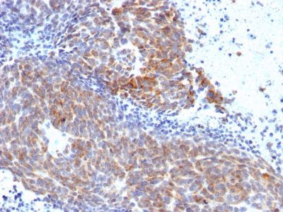 Topoisomerase I, Mitochondrial Monoclonal Mouse Antibody (TOP1MT/568)
