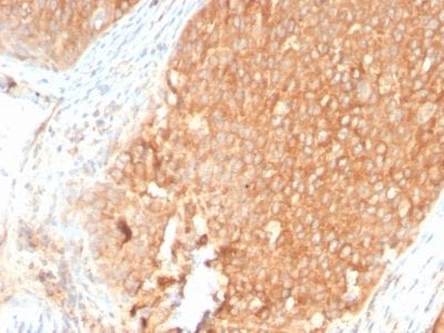 Topoisomerase I, Mitochondrial Recombinant Monoclonal Rabbit Antibody (TOP1MT/2883R)