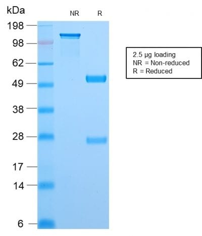 Topoisomerase I, Mitochondrial Recombinant Monoclonal Rabbit Antibody (TOP1MT/2883R)