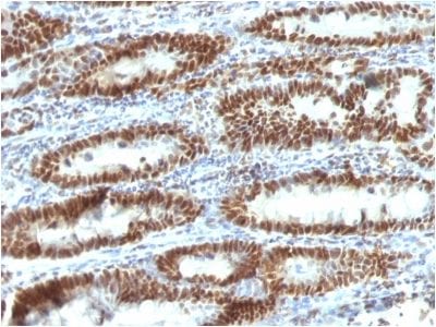 TOX3 Monoclonal Mouse Antibody (TOX3/1123)