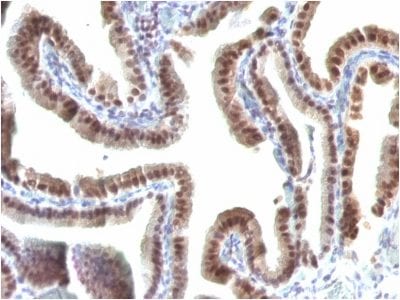 TOX3 Monoclonal Mouse Antibody (TOX3/1123)