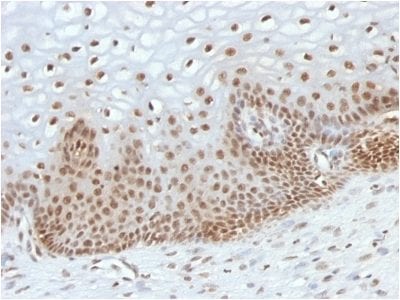 TOX3 Monoclonal Mouse Antibody (TOX3/1123)