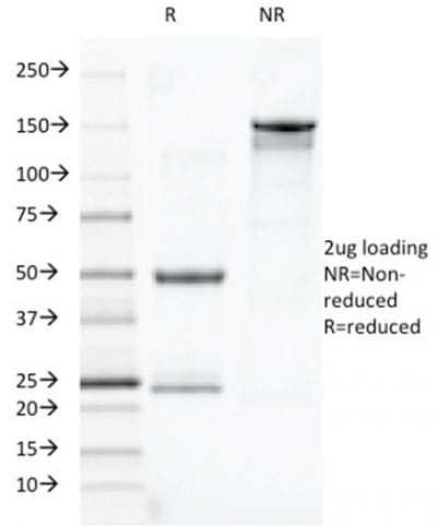 TOX3 Monoclonal Mouse Antibody (TOX3/1123)