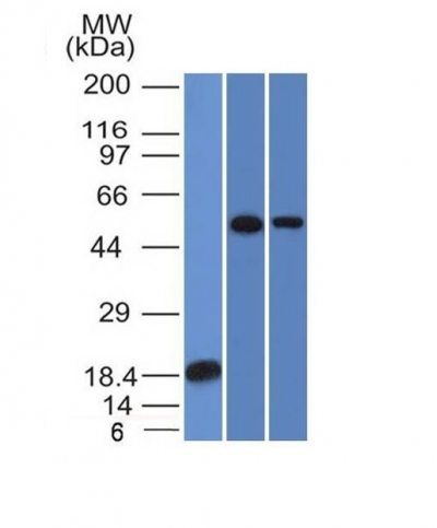 TOX3 Monoclonal Mouse Antibody (TOX3/1124)