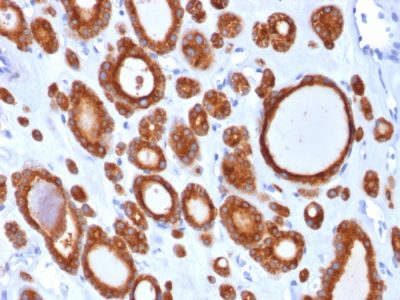 TPO Monoclonal Mouse Antibody (TPO/1921)