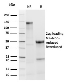 TPO Recombinant Monoclonal Rabbit Antibody (TPO/3813R)